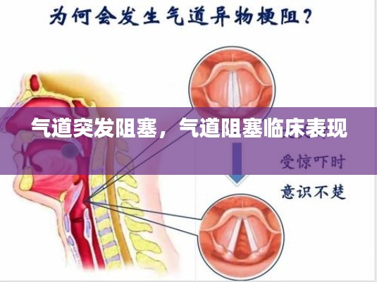 气道突发阻塞,气道阻塞临床表现
