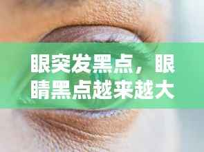眼突发黑点，眼睛黑点越来越大 